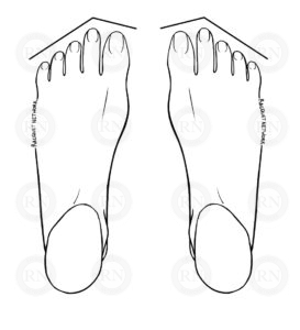 Diagram of a Morton's Toe toe line
